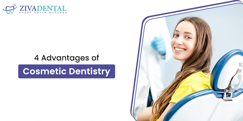 4 Advantages of Cosmetic Dentistry